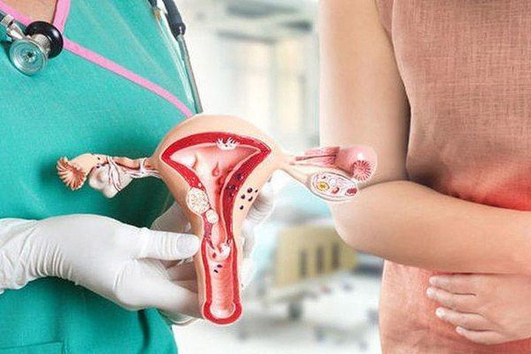 Lạc nội mạc tử cung là bệnh lý phụ khoa phổ biến