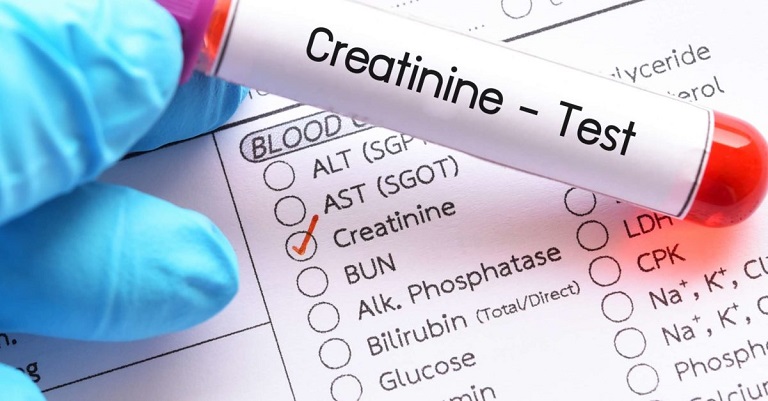 Xét nghiêm creatinin máu là một xét nghiệm quan trọng giúp đánh giá chức năng thận