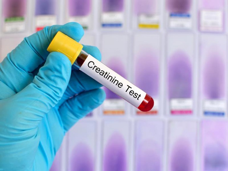 xét nghiệm creatinin là gì