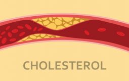 Cholesterol cao là bệnh lý gây nguy hiểm tới tính mạng