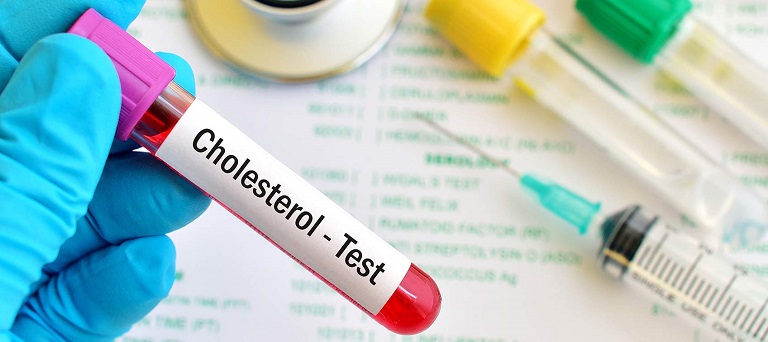 Xét nghiệm cholesterol là cách tốt nhất để kiểm tra, phòng ngừa cholesterol thấp