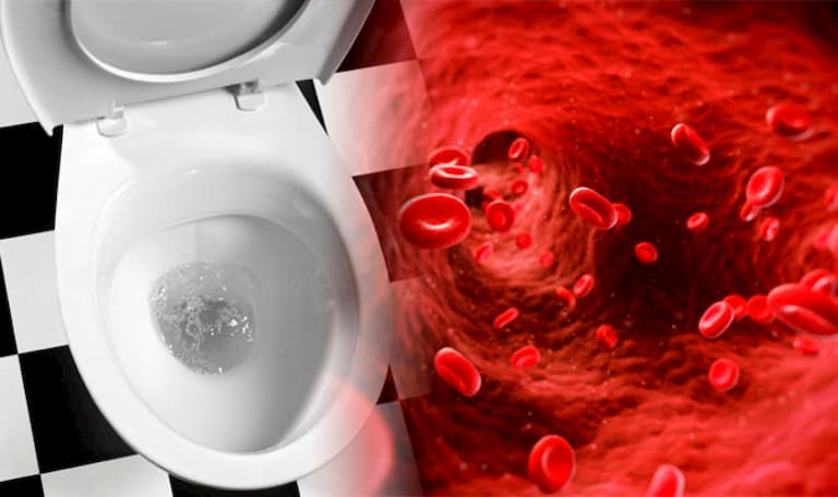 Tiểu ra máu có thể là dấu hiệu của các bệnh lý nguy hiểm