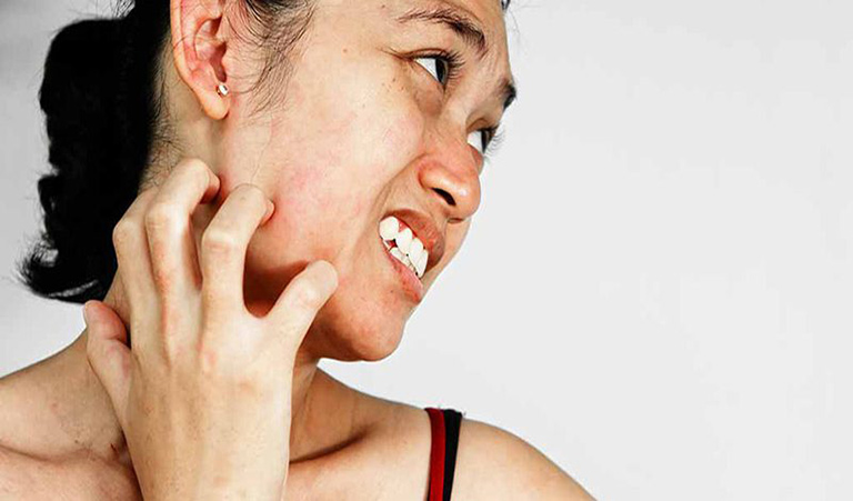 Ngứa da mặt là biểu hiên của căn bệnh viêm da