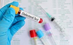 Xét Nghiệm Cholesterol Là Gì? Định Lượng Chỉ Số Cholesterol Trong Máu