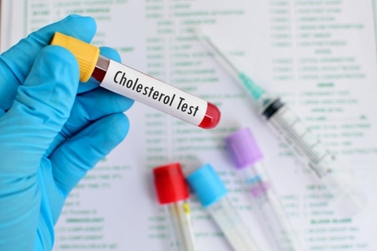 Xét nghiệm cholesterol là việc cần được thực hiện định kỳ