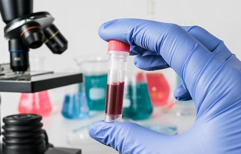 Xét nghiệm nhóm máu là kỹ thuật quan trọng người bệnh cần thực hiện