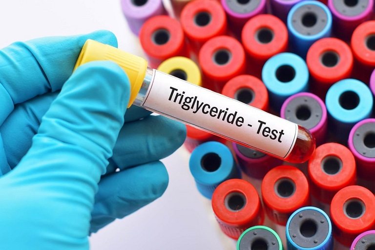 Xét nghiệm triglycerid là kỹ thuật cần được thực hiện định kỳ để kiểm tra tình trạng sức khỏe