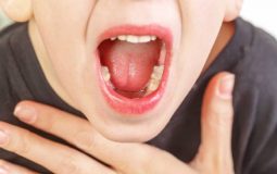 Viêm họng kéo dài là bệnh gì? Chẩn đoán và biện pháp điều trị dứt điểm
