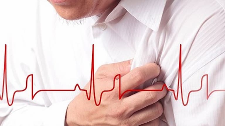 Viêm đa khớp có thể gây ảnh hưởng đến cả hệ thống tim mạch