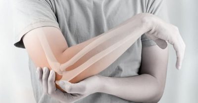 3 biện pháp điều trị đau khớp khuỷu tay hiệu quả, an toàn nhất