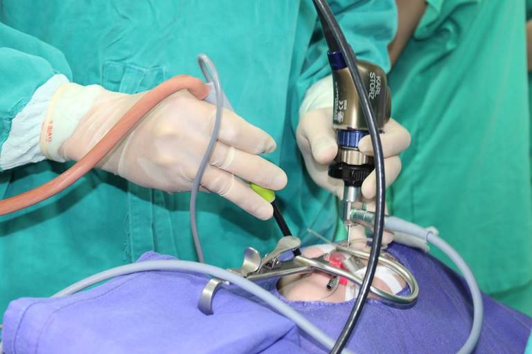 Phương pháp phẫu thuật cắt amidan khá tối ưu cho ai muốn điều trị tận gốc bệnh