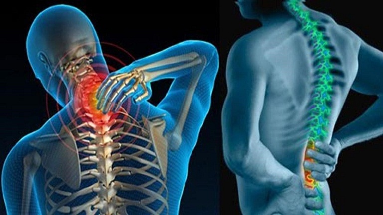 Các phương pháp chụp X-quang giúp người bệnh nhìn rõ được tình trạng xương khớp của mình