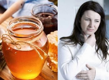 TOP 11 cách chữa viêm amidan hốc mủ bằng mật ong hiệu quả bạn nên biết