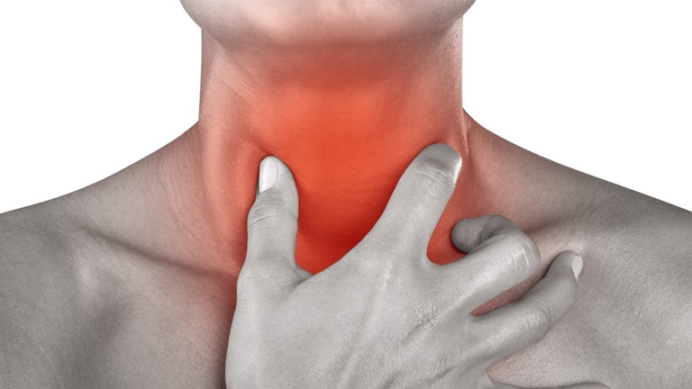 Dấu hiệu của viêm amidan mãn tính thường là đau rát cổ họng.