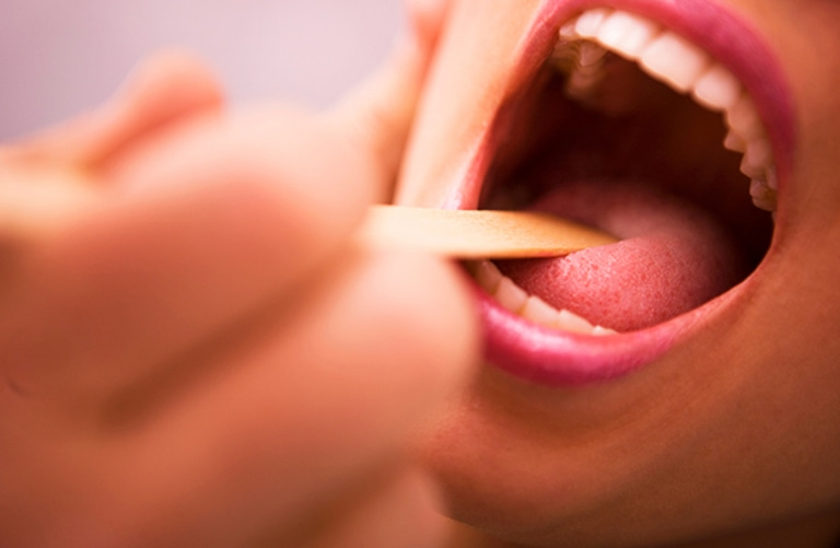 Người bệnh nên thực hiện thăm khám khi có những biểu hiện như đau rát cổ họng.