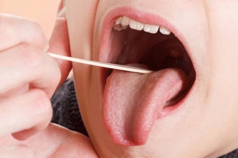 Các bác sĩ kiểm tra sơ bộ các triệu chứng ở amidan lưỡi của bệnh nhân