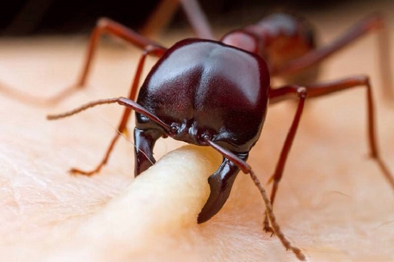 Khi bị côn trùng cắn có thể gây phát ban đỏ không sốt