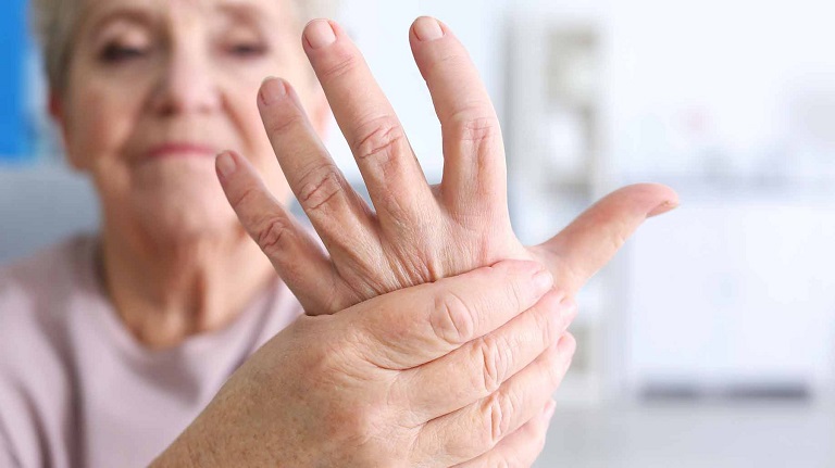 Viêm khớp dạng thấp khiến tay của người bệnh bị sưng viêm đau nhức