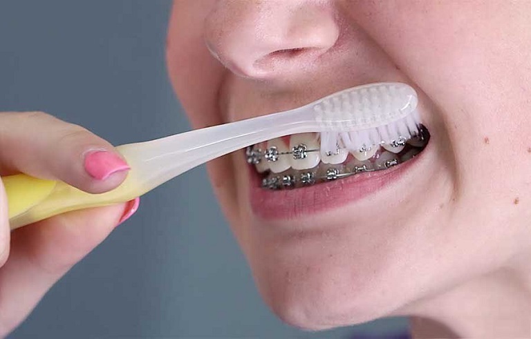 Mỗi ngày cần đánh răng ít nhất 2 lần, nhất là vào thời điểm sau khi ăn xong