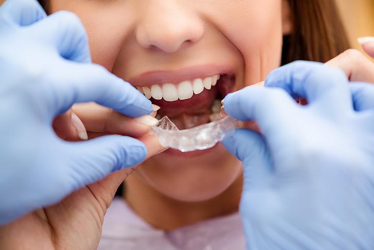 Bạn nên lựa chọn các bệnh viện và trung tâm nha khoa lớn để đảm bảo an toàn khi niềng răng
