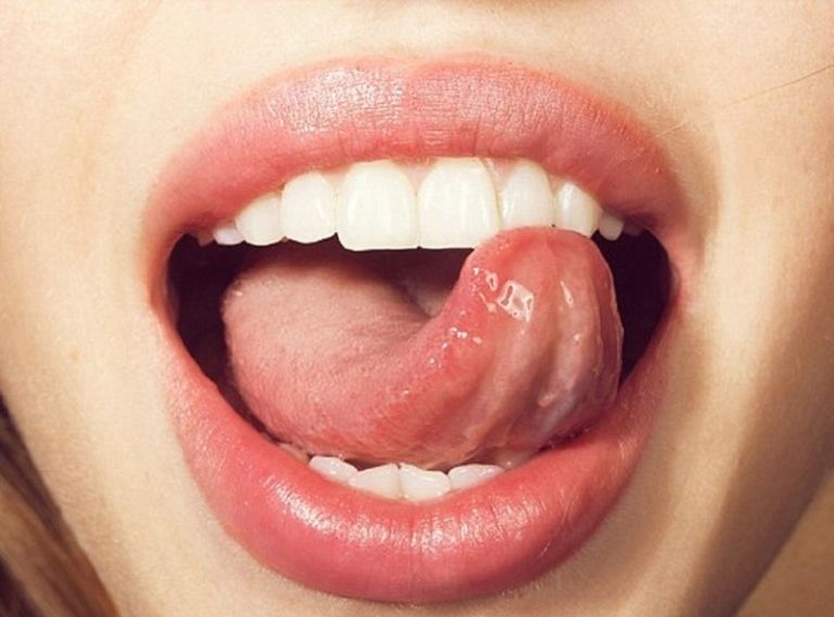 Sử dụng lưỡi đẩy là cách làm răng bớt hô tại nhà