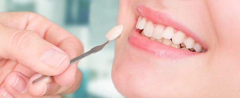 Bọc răng sứ sẽ đem tới hiệu quả phục hình lâu dài, bền vững