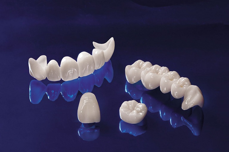 Răng sứ Cercon sở hữu 16 tông màu răng đa dạng