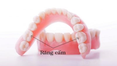 Răng cấm là răng hàm nằm tại vị trí số 6 trên cung hàm