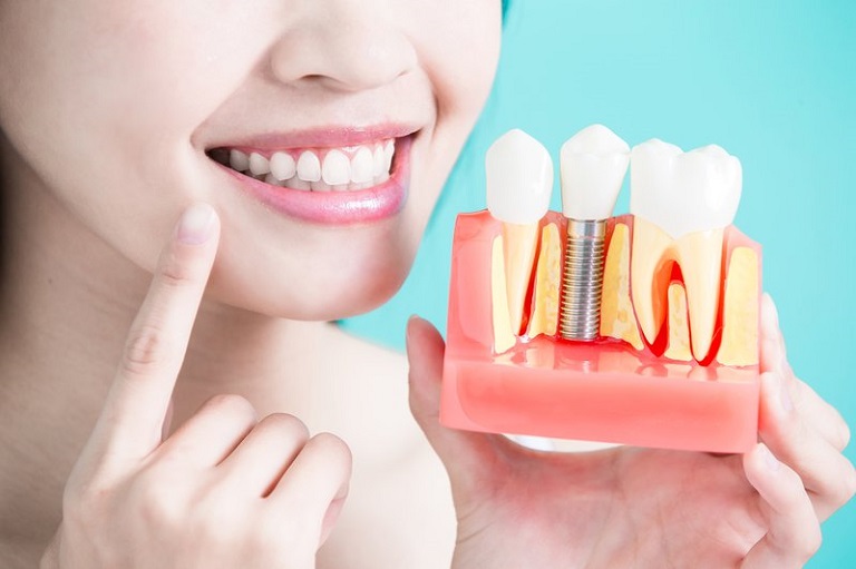 Trồng răng cố định phải thực hiện tại nha khoa uy tín để đảm bảo an toàn