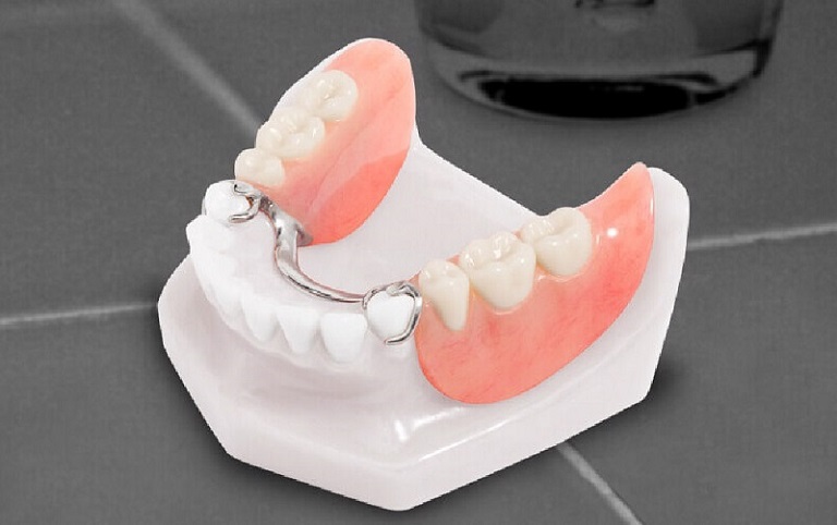 Hàm giả thường có cấu tạo bằng 2 bộ phận chính là nền hàm và răng giả