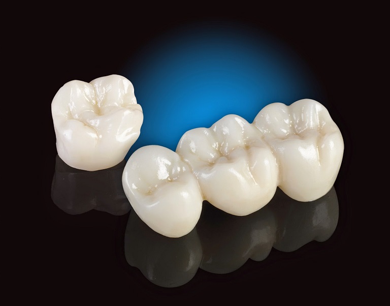Răng toàn sứ được sản xuất với chất liệu cao cấp, công nghệ hiện đại