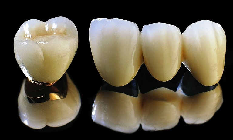 Răng sứ titan vita có nguồn gốc từ Đức, được sản xuất bởi công ty Vita