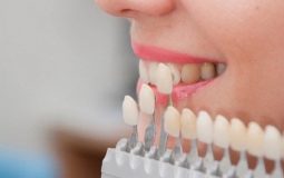 Quy trình thực hiện trồng răng sứ diễn ra vô cùng đơn giản