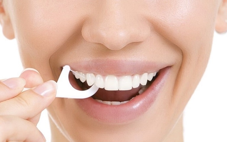 Sử dụng chỉ nha khoa để loại bỏ thức ăn thừa, mảng bám trên răng