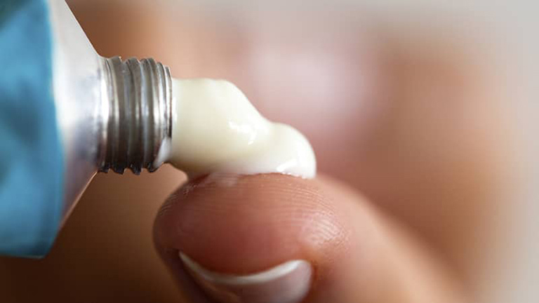 Người bệnh có thể sử dụng các loại kem bôi đặc trị ngoài da để điều trị