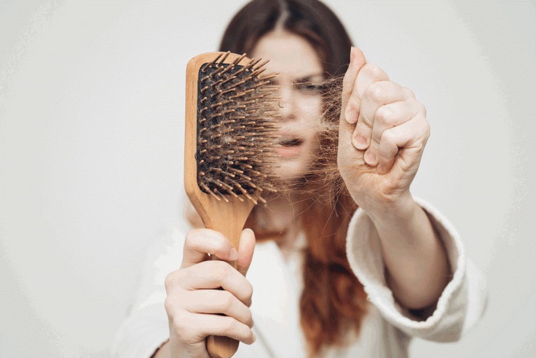 Nhiều người bệnh gặp phải tình trạng rụng tóc do bệnh á sừng trên da đầu gây ra