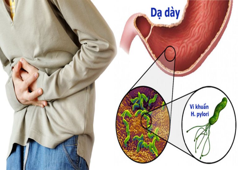 Vi khuẩn HP xâm nhập vào cơ thể qua đường ăn uống gây ra bệnh đau dạ dày
