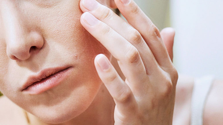 Bạn hạn chế đưa tay sờ vào mặt hay gãi mạnh để tránh nhiễm trùng