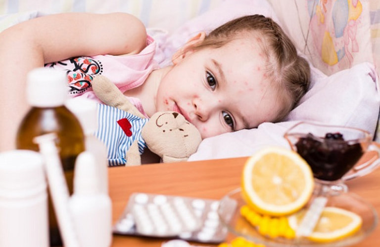 Dùng thuốc Tây để hạ sốt và giảm ngứa cho trẻ