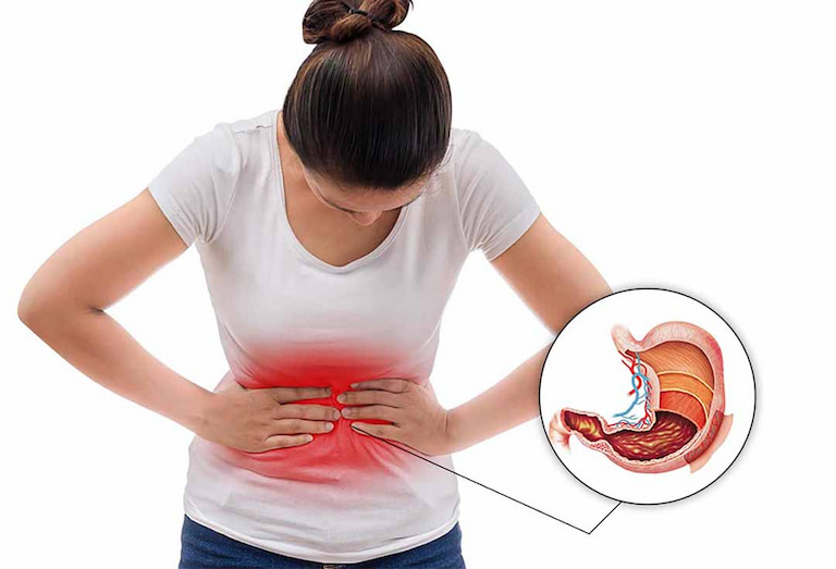Đau dạ dày ở vị trí bên trái bụng xảy ra khá phổ biến