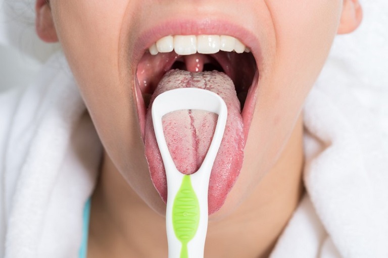 Vệ sinh lưỡi với thiết bị chuyên dụng giúp cải thiện triệu chứng