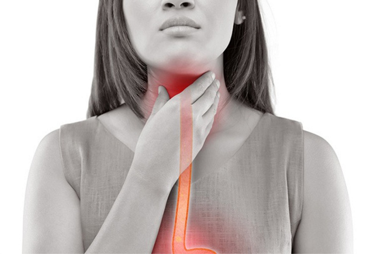 Trào ngược dạ dày nghẹn cổ họng là bệnh thường gặp