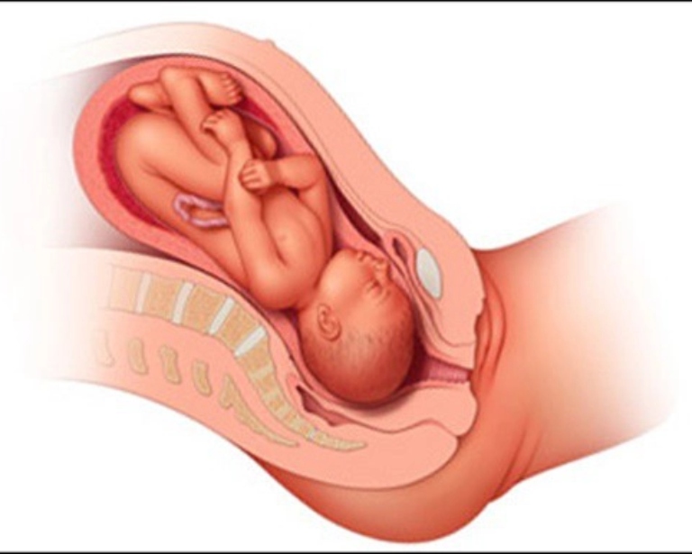 Rủi ro có thể xảy ra khi dùng nghệ cho bà bầu là kích thích tử cung