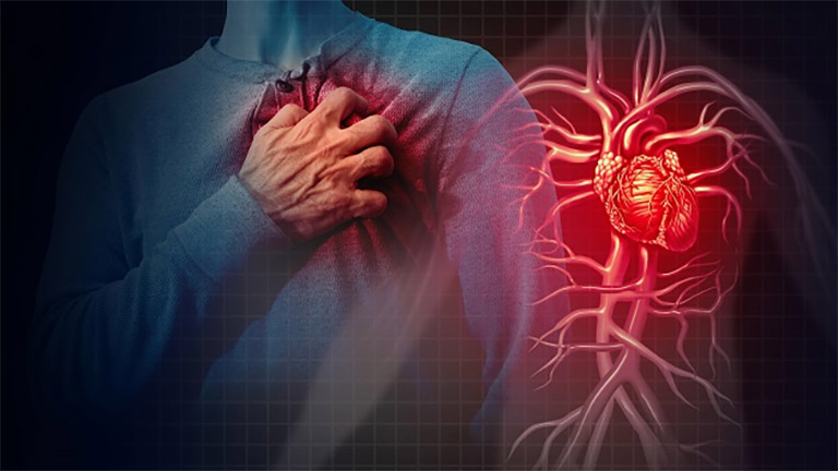 Viêm đau khớp có thể biến chứng bệnh tim mạch