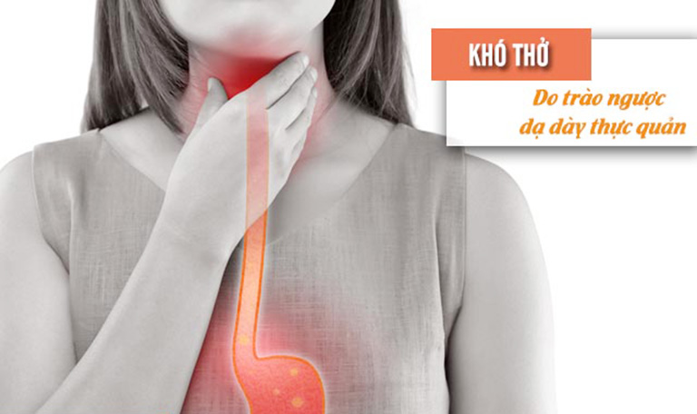 Khó thở là một triệu chứng của bệnh trào ngược dạ dày dạ dày - thực quản (GERD)