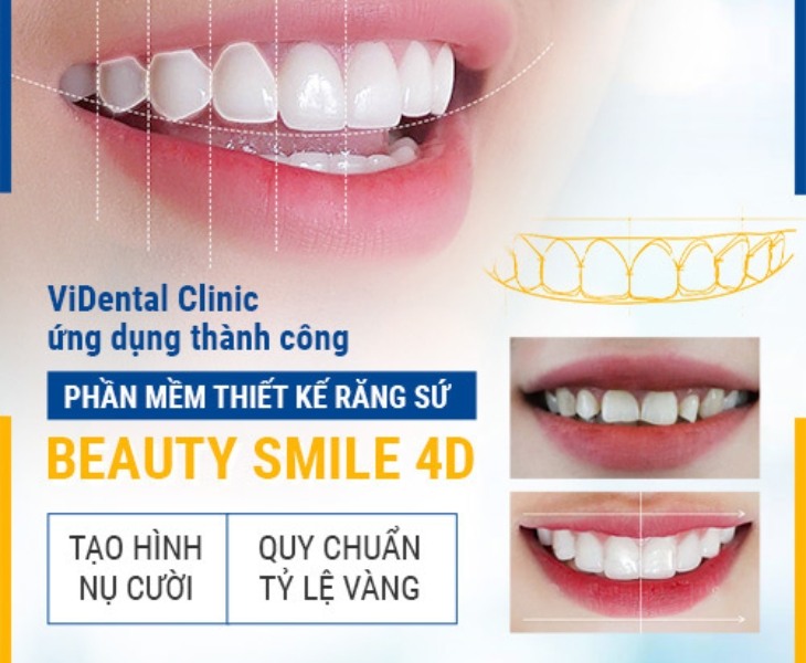 Phần mềm thiết kế răng sứ Beauty Smile 4D hiện đại