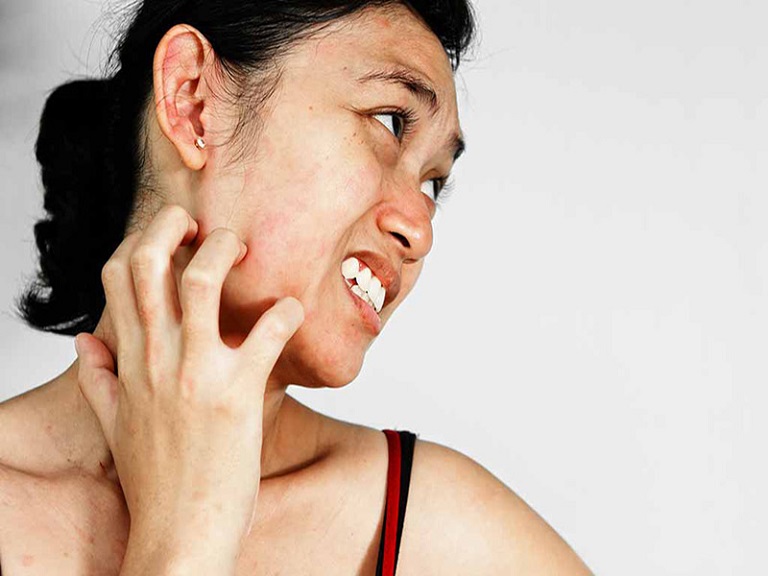 Phần lớn tình trạng da mặt bị ngứa đều không quá nghiêm trọng